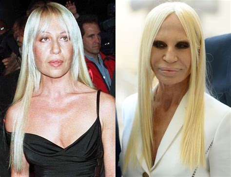 donatella versace credibilità|donatella versace before and after.